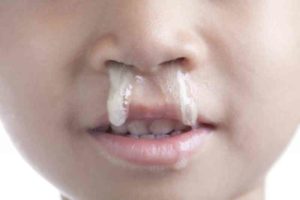 Белые сопли у ребенка