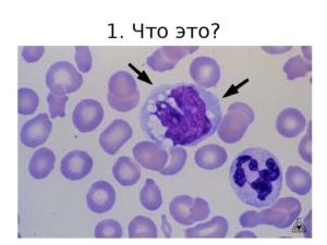 Вакуолизация в цитопл. Моноцитов