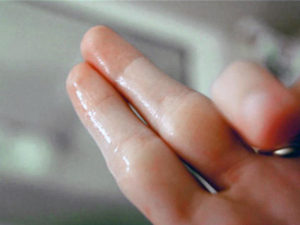 Водянистые выделения при беременности