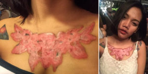 Знобит после тату