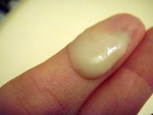 Водянистые выделения при беременности