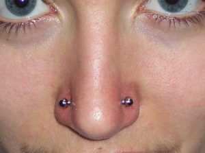 Образование шишки на месте прокола носа