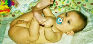 Рождение мальчика с открытой головкой на писюне