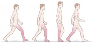 Головокружения и шаткость на улице