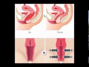 Влагалище во врея секса то узко то широко