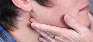 Не проходят воспаленные лимфоузлы