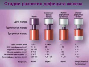 Низкий ферритин при нормальном гемоглобине