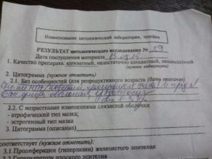 Цитограмма без особенностей