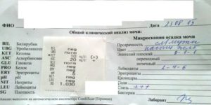 Анализ мочи положительный? Что будет?