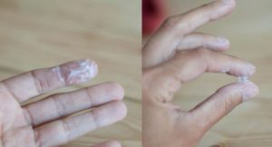 Водянистые выделения при беременности