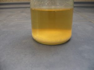 Песок в моче кирпичного цвета в осадке