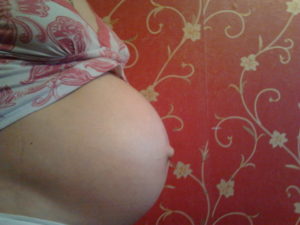 Вылез пупок во время беременности