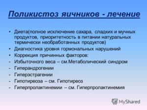 Поликистоз яичников. Как лечить?