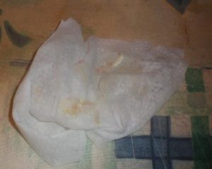 Ребёнок срыгивает с кровью