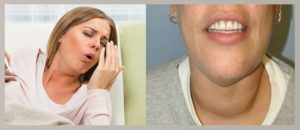 Рак 4 стадия одышка и отеки