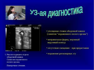 Симптом поражения полого органа