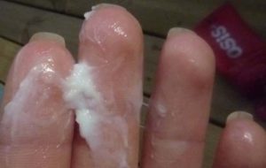 Белые выделения после занятий спортом