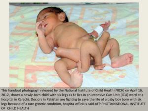 Рождение мальчика с открытой головкой на писюне