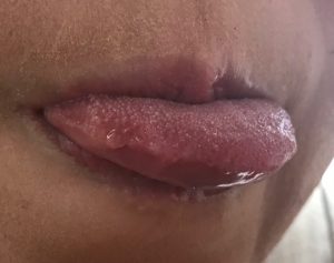 Белое образование на языке