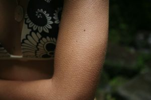 У левого плеча как будто бегают мурашки