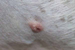 Болезненные шишки после укуса клеща