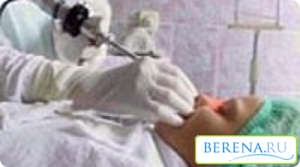 Аденоиды у ребенка, операция под наркозом