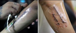 Сыпь после пленки для тату Супрофорб