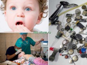 Ребенок проглотил деревянный шарик, и он не вышел. Что делать?