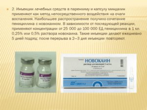 Хронический тонзиллит и уколы бициллина помогают ли