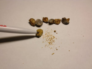 Песок в почках