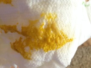 Кислый запах кала у ребенка