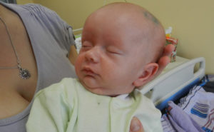 Большая голова у плода