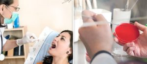 Когда самое раннее после заражения показывает мазок на коклюш