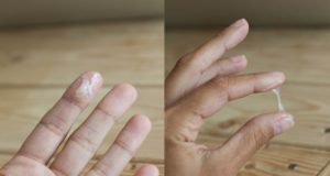 ЯБ при овуляции