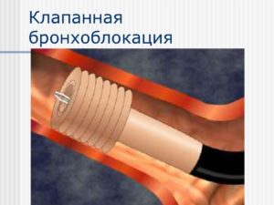 Последствие бронхоблокатора