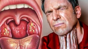 Боль глубоко в горле