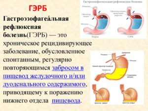 ГЭРБ (Мешает в повседневной жизни)