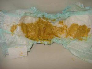 Ребенок 5 лет стал часто какать