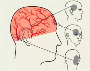 Толчки в голове