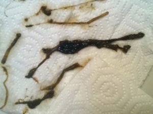 Месячные идут 8 дней