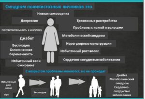 Поликистоз яичников. Как лечить?