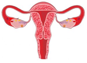 Маточное кровотечение, рак