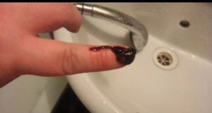 Месячные идут 8 дней