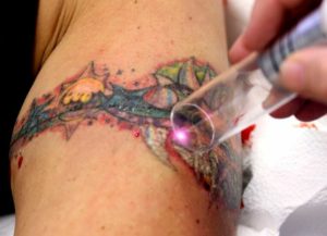 Знобит после тату