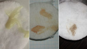 Мазня после месячных 5 дней