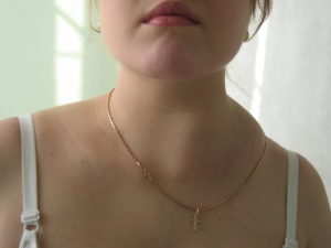 Припухлость в области надключичной ямки