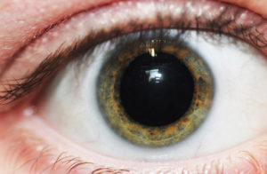 Глаз тровмирован, зрачок расширен, плохо реагирует на свет