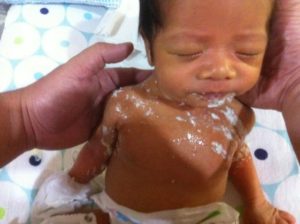 Ребёнок срыгивает с кровью