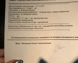 Срок по узи больше чем по месячным