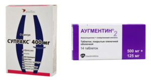 Аугментин или супракс